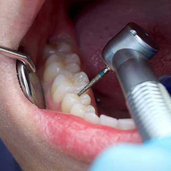 دندان پزشکی خمینی شهر