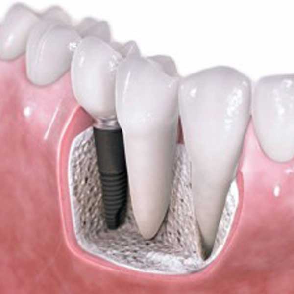 دندان پزشکی خمینی شهر