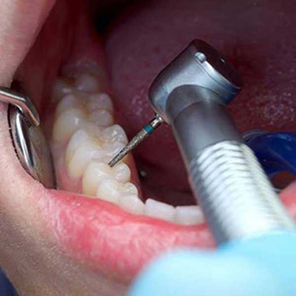 دندانپزشکی خمینی شهر
