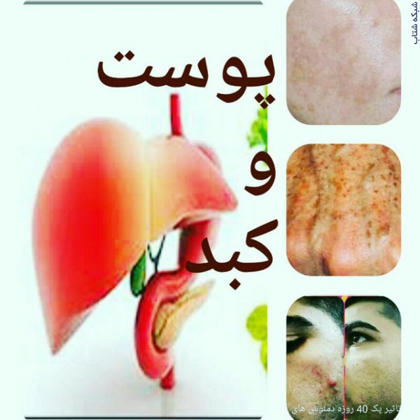 http://asreesfahan.com/AdvertisementSites/1399/02/03/main/IMG-20200420-WA0016.jpg